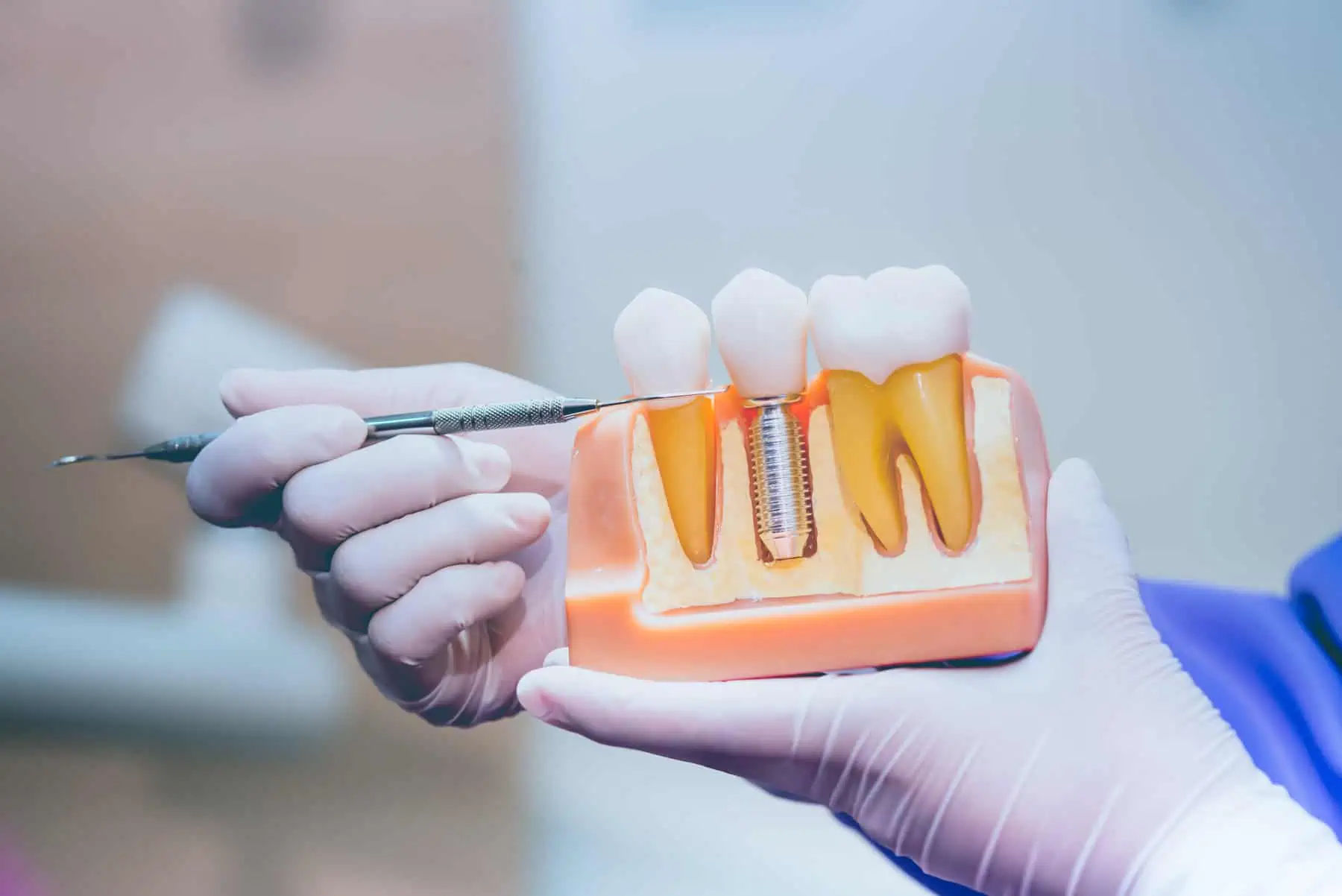 Smiling patient admiring her restored smile after dental implants